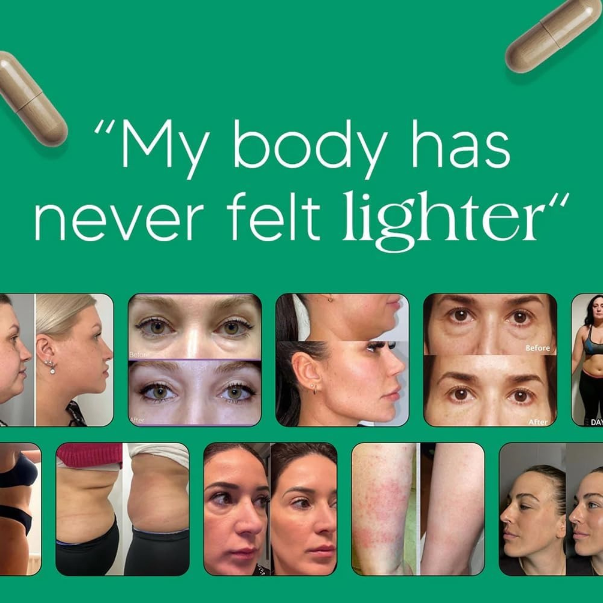 ShapeDrops™ Lymphatic Drainage Supplement