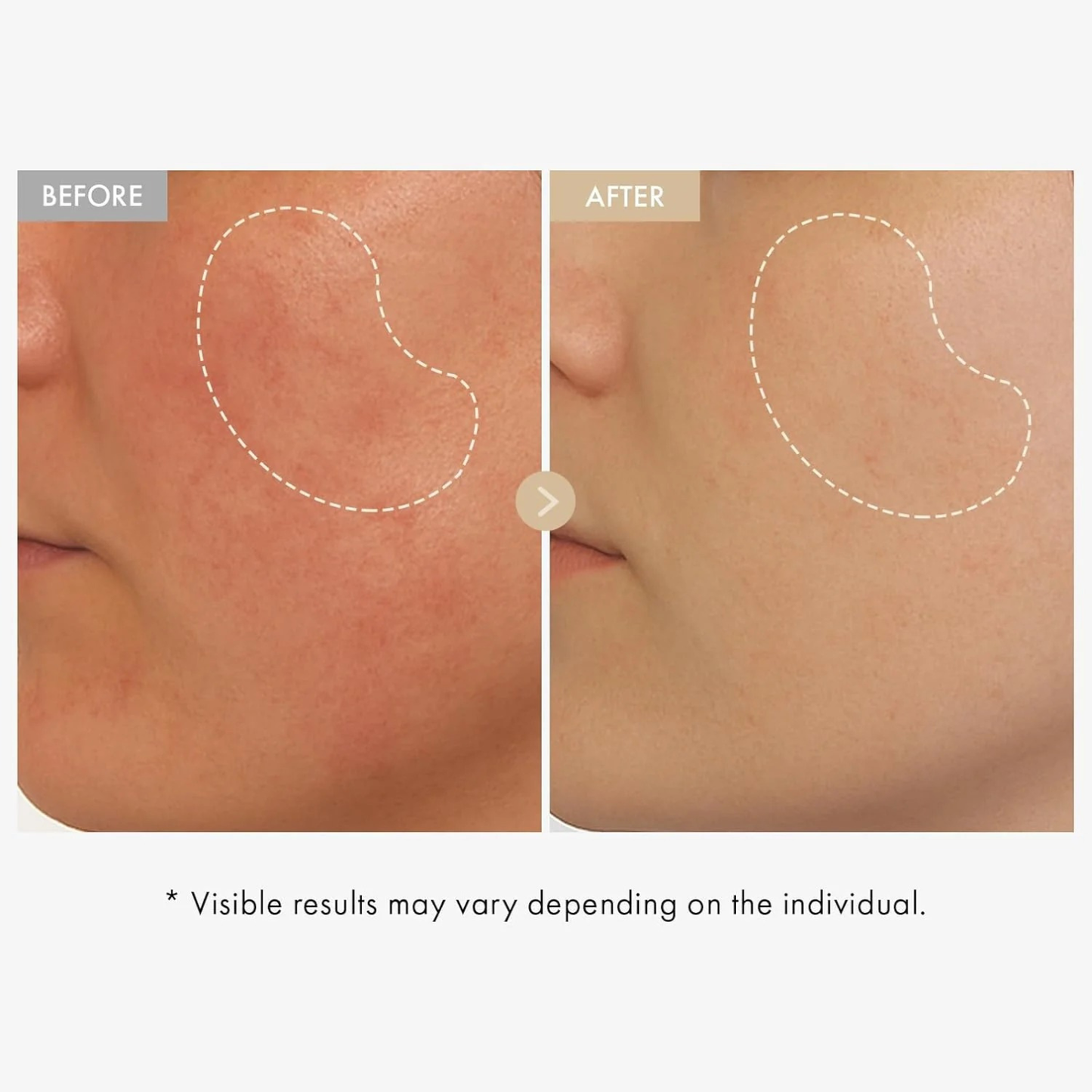 ShapeDrops™ Rice Glow Serum